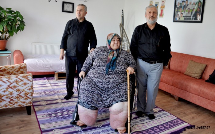 Fil Hastası Güler’in tekerlekli sandalye sevinci