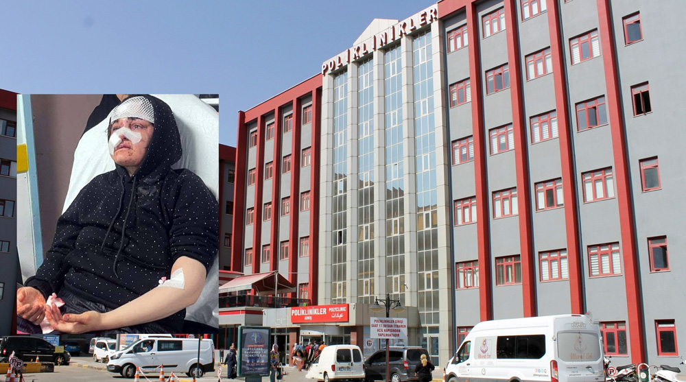 BOŞANMAK İSTEYEN EŞİNİ TAŞLA DÖVDÜ